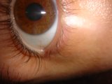 Brown-Eyed Stare