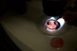 Microscopic Examination of a Red Liquid