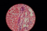 Pink and White Egg Stain