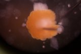 Microscopic View of a Jellyfish