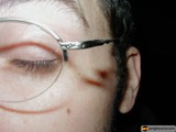 Bruised but Bold