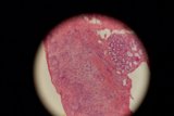 Stained Tissue Sample