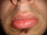 The Red Tongue