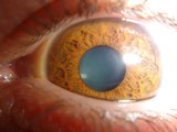 The Blue-eyed Wonder