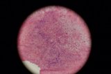 Pink and White Spotted Sphere