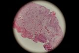 Stained Sphere in Tissue Plate