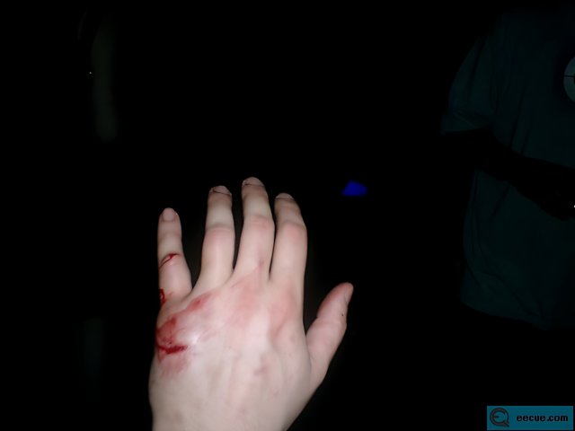 Bloodied Hand in Darkness