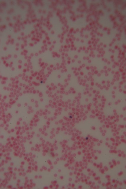 Red and White Cell Close-Up