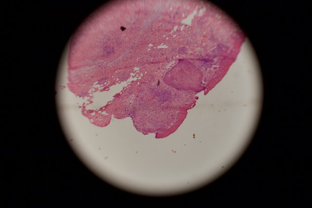 Pink Stain on Black Surface
