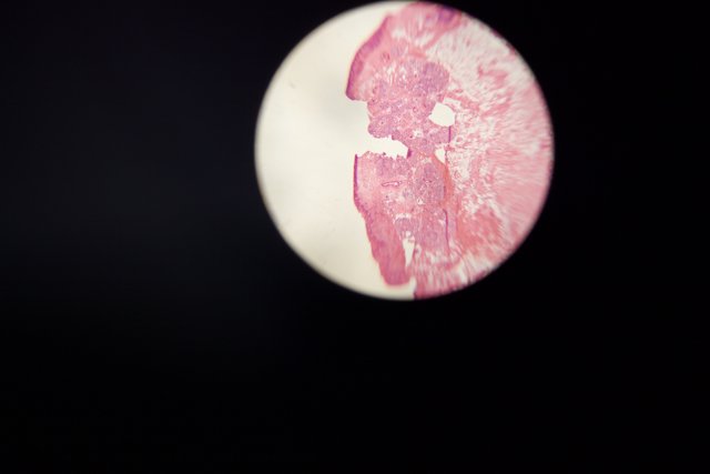 Pink and White Stain Captured in Micrograph