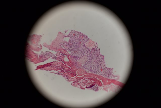 Stained Tissue Micrograph