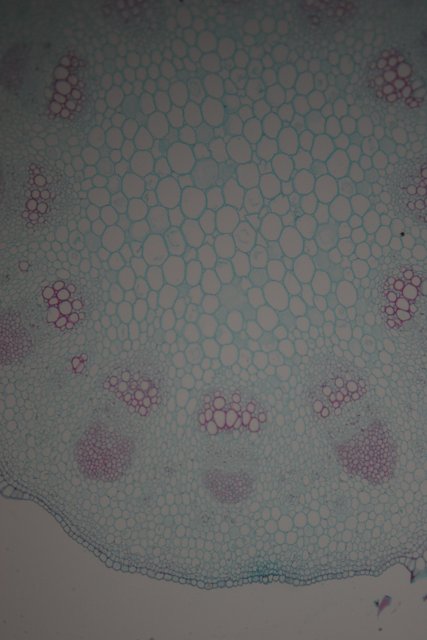 The Foamy Texture of a Plant Cell