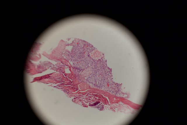Stained Tissue in Close-up