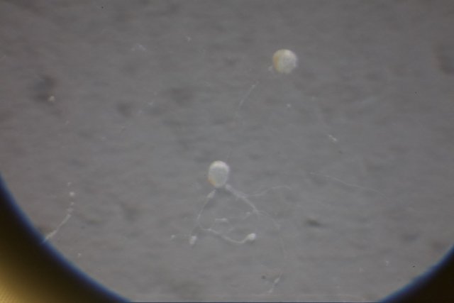 Jellyfish Under the Lens