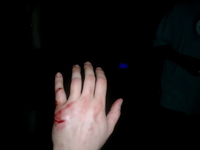 Bloodied Hand in the Dark