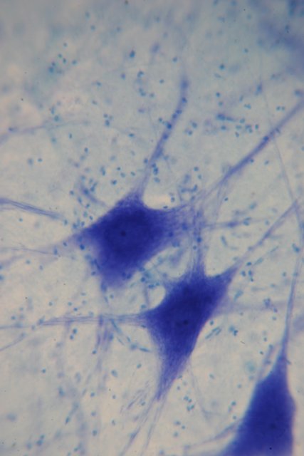 Blue Spots in the Cell