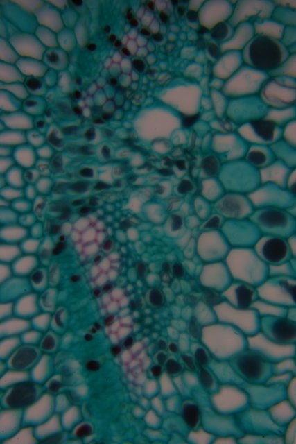 Cellular Patterns in Turquoise