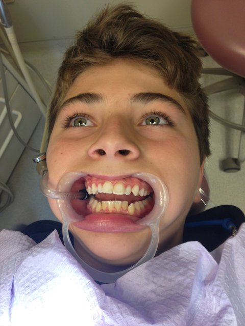 Flashing a Grin: The Pre-Dentist Adventure