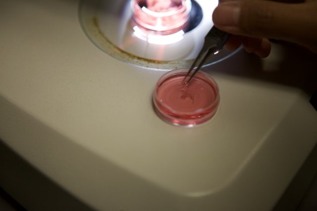 Microscopic Investigation of Pink Substance