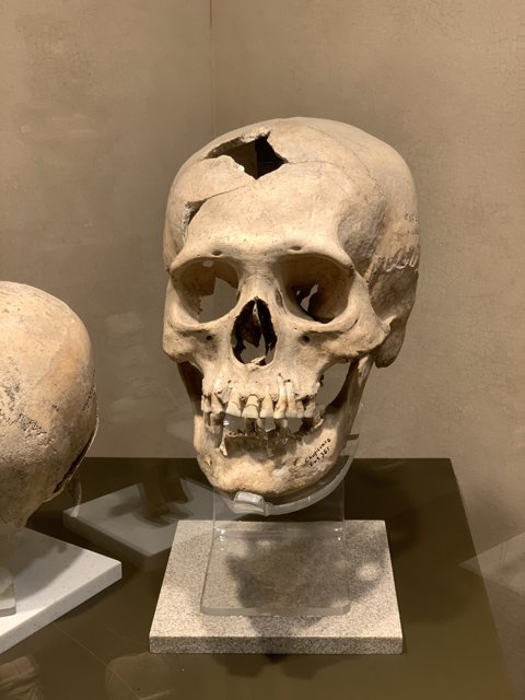 A Museum Display of Ancient Skulls