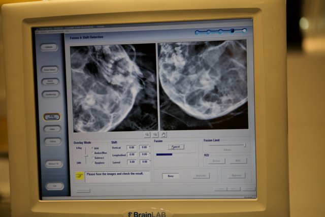 Medical Imaging on Computer Screen