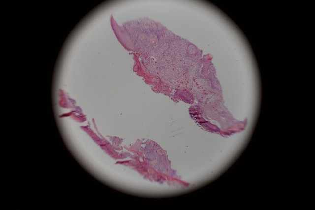 Stained Tissue under the Microscope