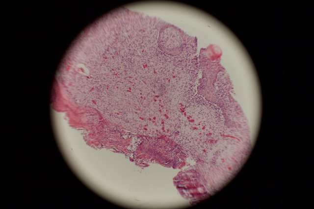 Stained Sphere in Tissue Plate