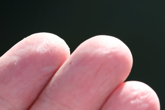 A Mysterious White Dot on the Finger