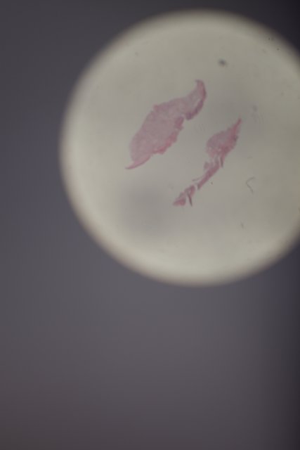 Pink Egg Stain on White Plate