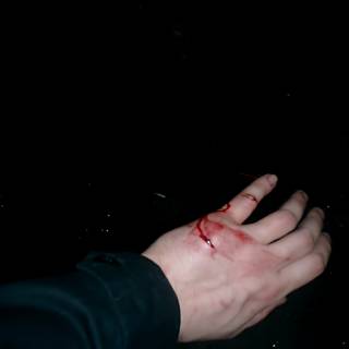 bloody hand