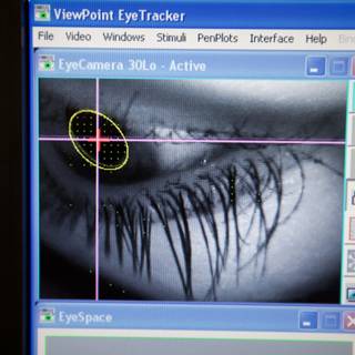 Visualizing Eye Implants on a Computer Screen