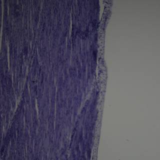Purple Tissue: A Work of Art