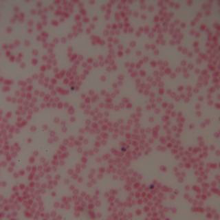 Red and White Cell Close-Up
