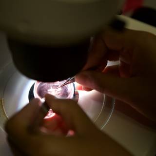 Microscopic Examination