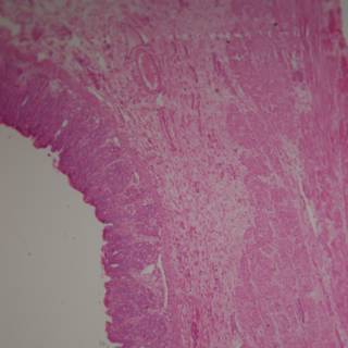 Pink Tissue with a White Line