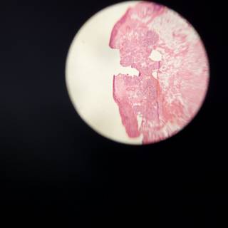 Pink and White Stained Sphere