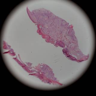 Stained Tissue Micrograph