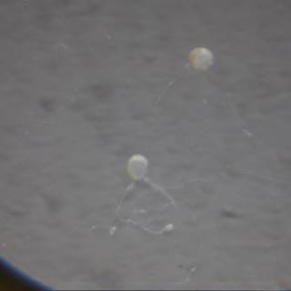 Jellyfish Under the Lens