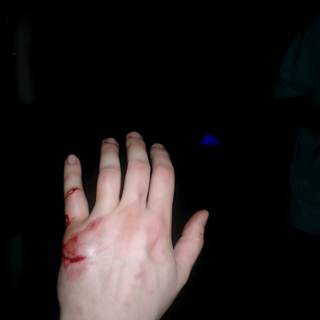 2004 bloody hand