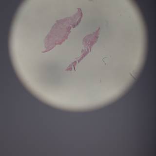 Pink Egg Stain