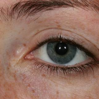 Freckled Eye
