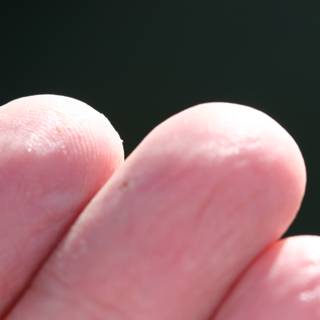 A Mysterious White Dot on the Finger