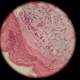 Pink and White Sphere Tissue