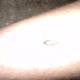 Bug on Man's Arm