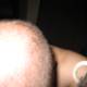 Bald Man with a Tattooed Skin